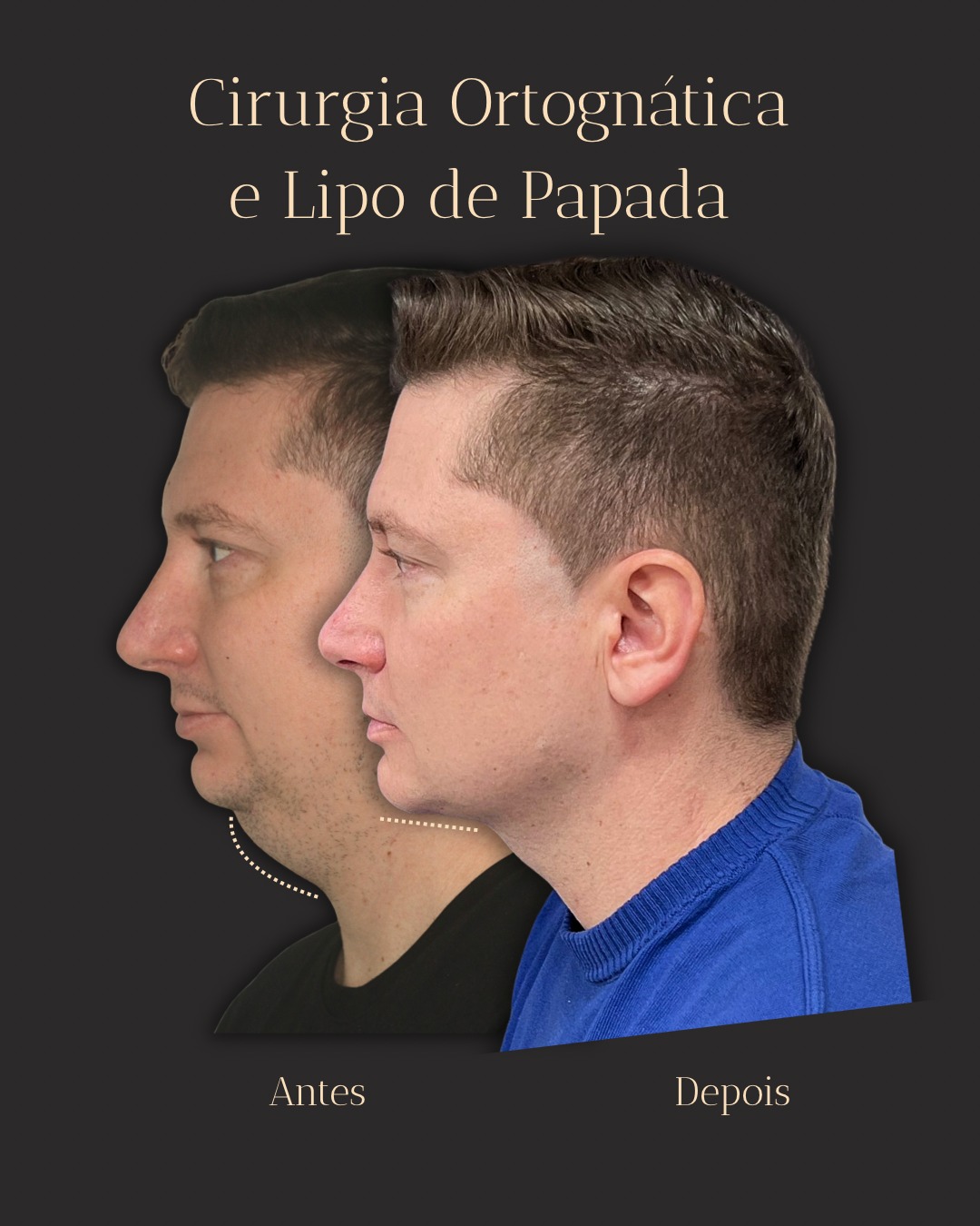 Antes e depois 1