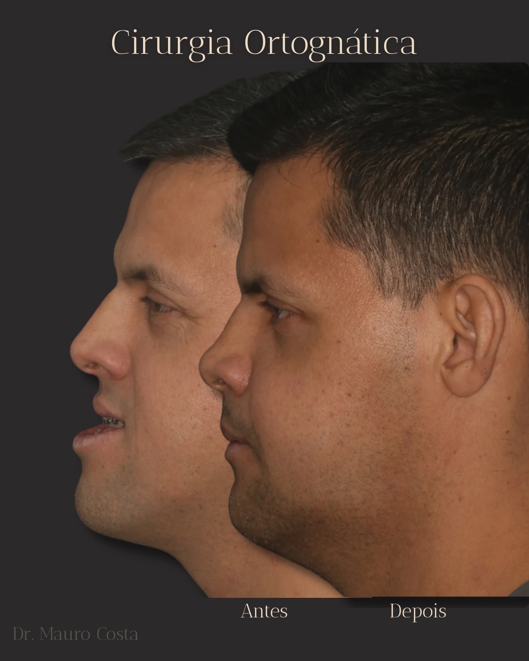 Antes e depois 1