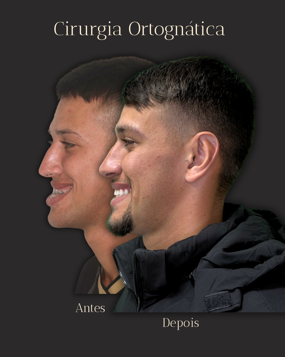 Antes e depois 3